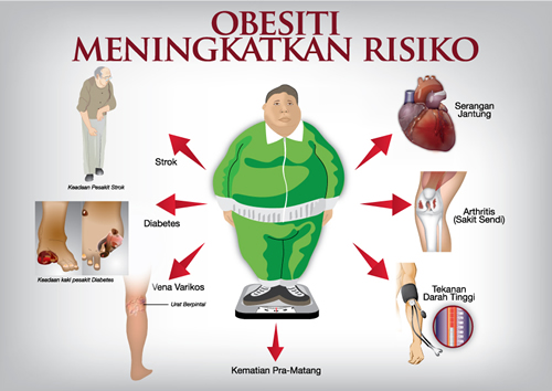 Masalah Obesiti - Green Coffe - Kopi Hijau